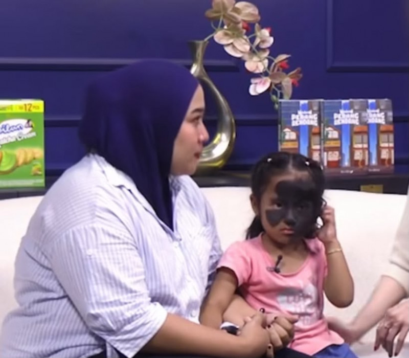 Viral Ibu Cerita Anak Lahir dengan Tanda Hitam di Wajah, Sara Wijayanto Luruskan Mitos Soal Mimpi dan Pantai