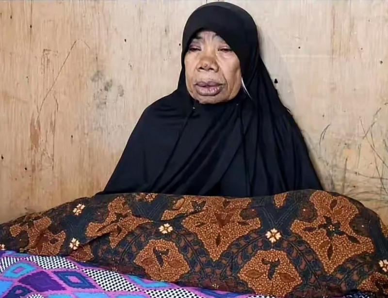 Balita di Bulukumba Meninggal Usai 10 Hari Tak Dapat Asupan, Diduga Ensefalopati dan Gizi Buruk